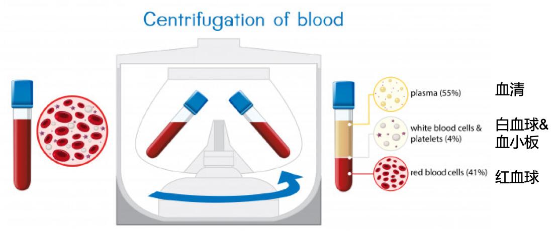 熊猫血怎么输血,熊猫血可以自体采血吗