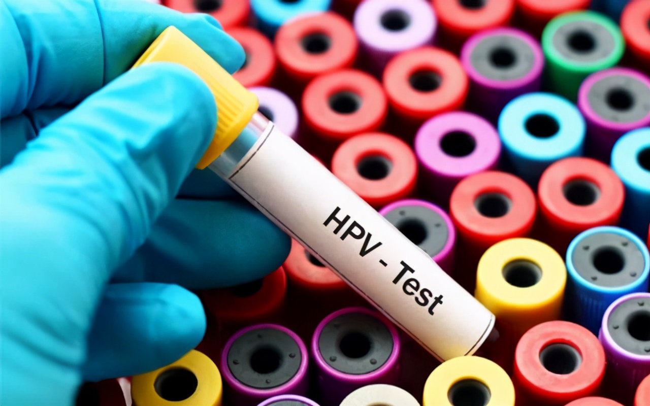 hpv活检是什么意思,hpv11阳性活检报告