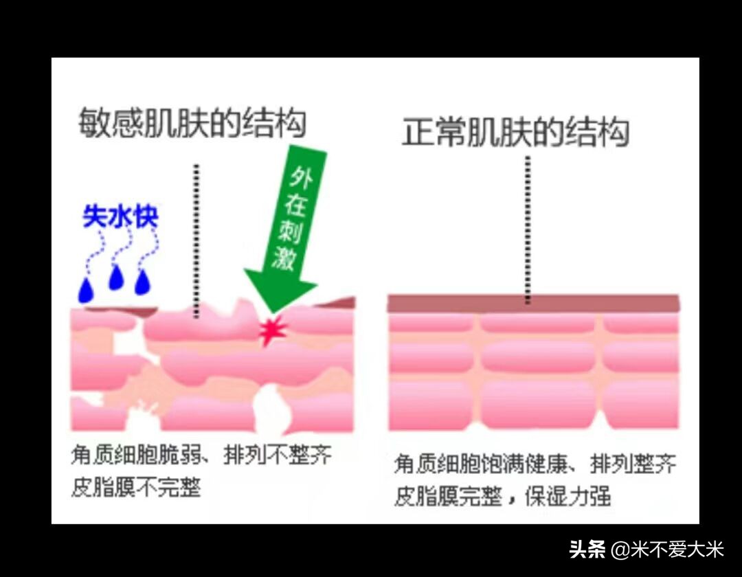 让我告诉你如何像范冰冰舒淇等女星那样治好自己的过敏肌肤