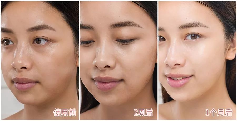 医美让女明星集体回春,女明星医美集体回春