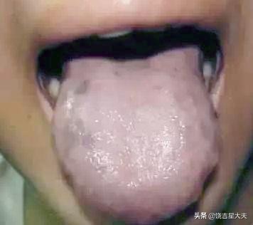 中医晚上口渴老想喝水什么原因,老中医告诉你一到晚上就口干