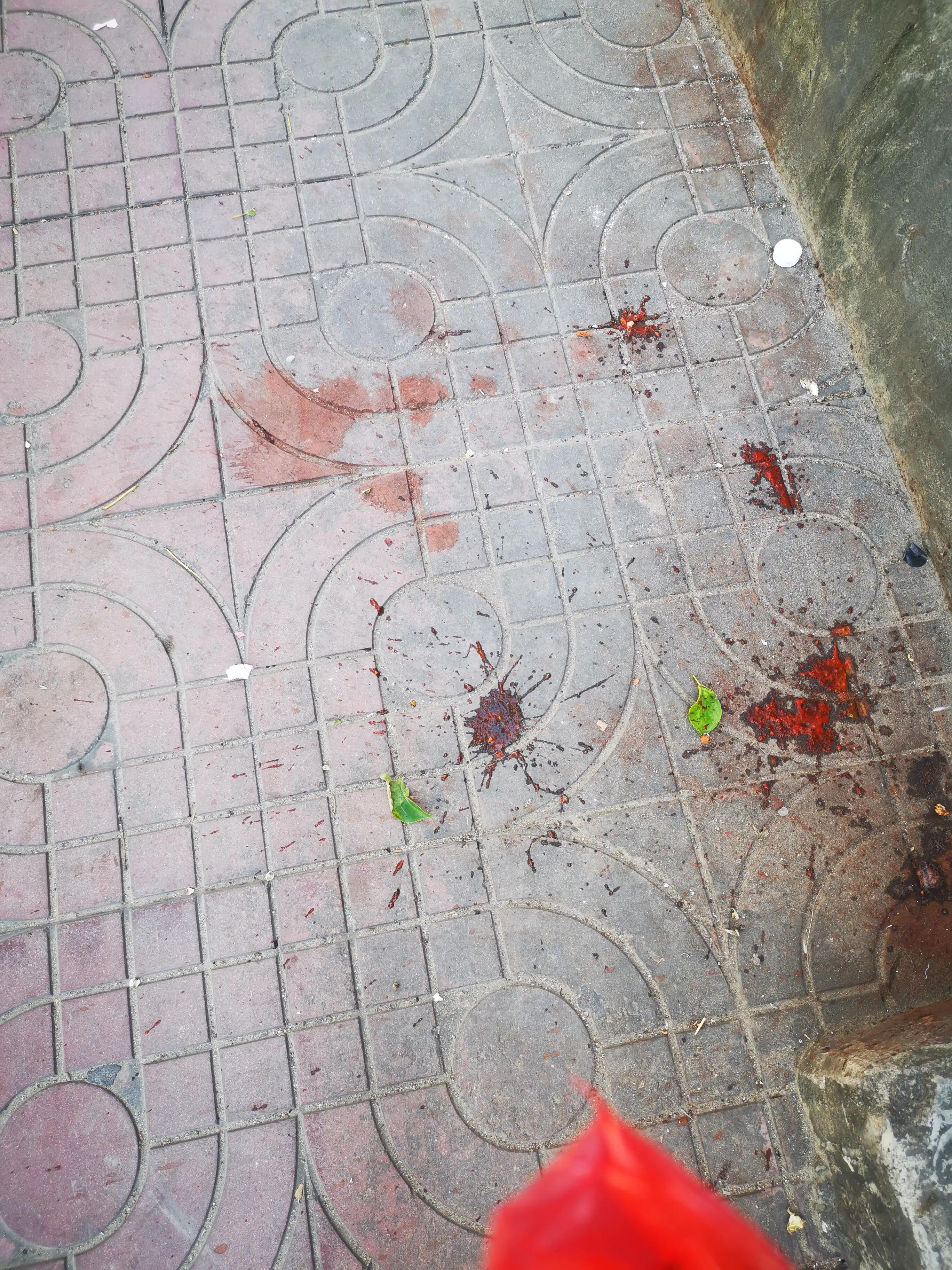 吃槟榔之后不能吃什么,吃槟榔之后的样子