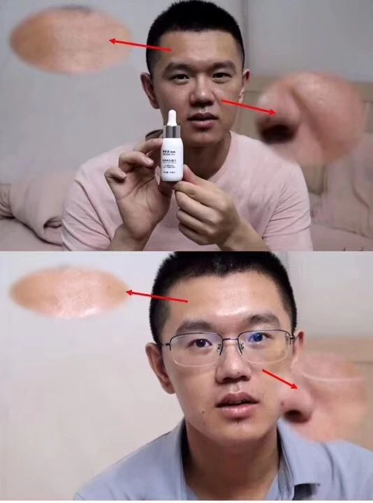 烟酰胺可以祛黄提亮美白吗,美白去黄精华最有效