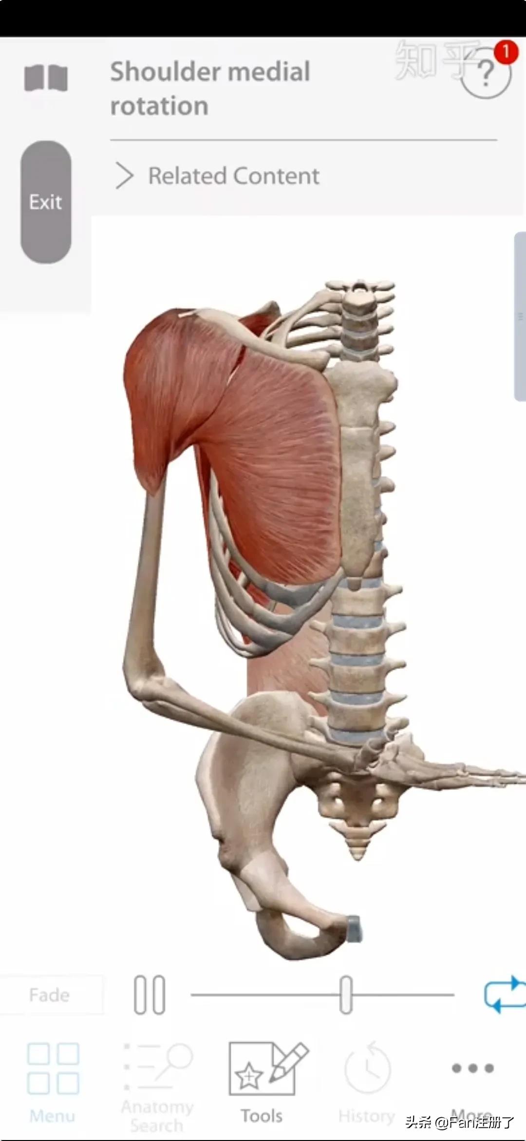 肩痛肩袖损伤针刀治疗,肩痛肩关节活动受限用什么药