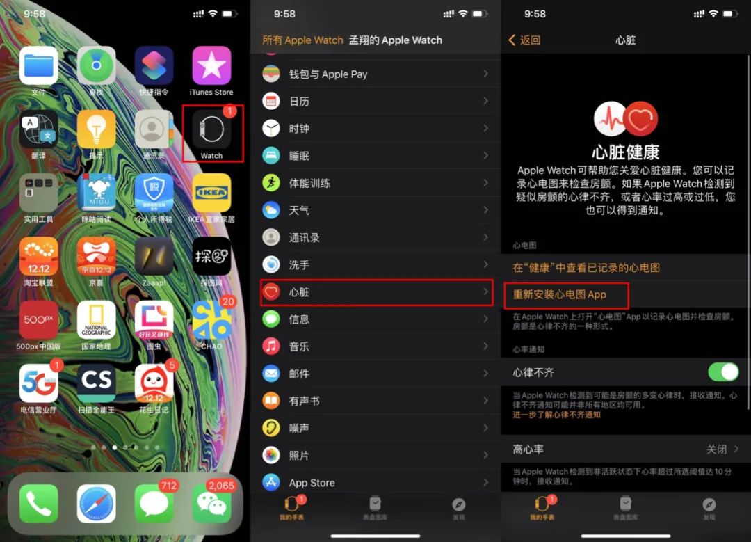 applewatch测ecg心电图,applewatch如何激活ecg