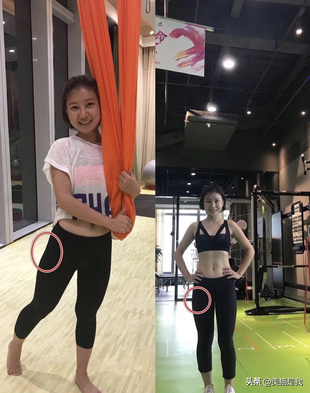 你不是腿短，而是加胯宽，科学矫正假垮宽，修炼长腿第一步！