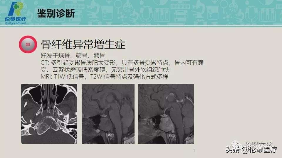 上海教授詹松华,上海曙光医院詹松华简介