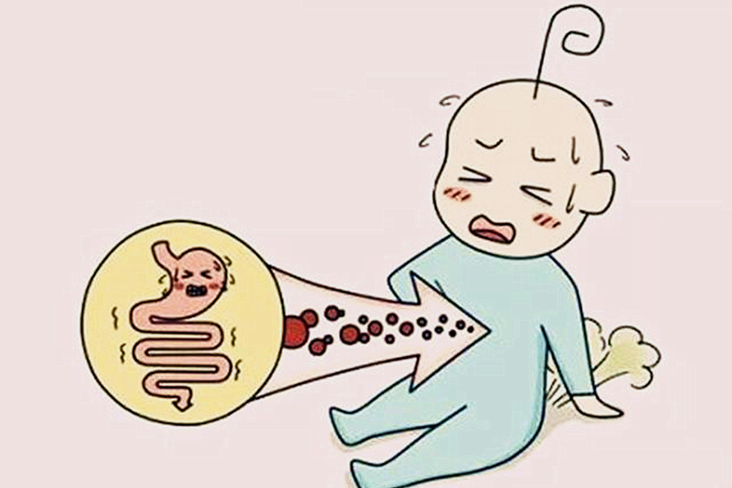 宝宝不放屁是胀气吗,宝宝不放屁但是有大便