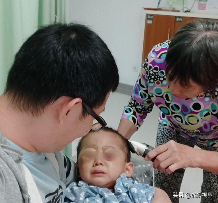 小孩摔一跤后引起眼袋淤青,2岁多男宝眼袋浮肿有点发紫