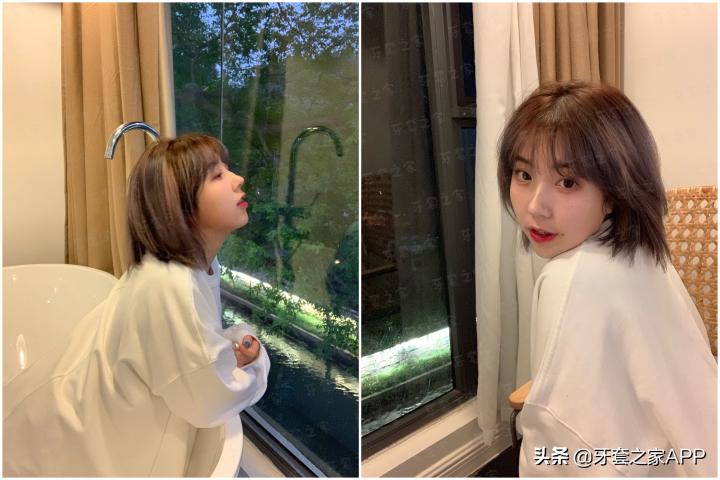 不靠整容怎么改变下巴后缩？看这里