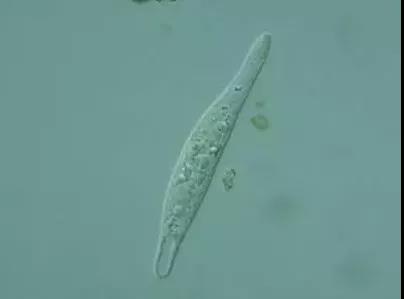 污泥镜检操作方法,污泥检测项目及标准有哪些呢