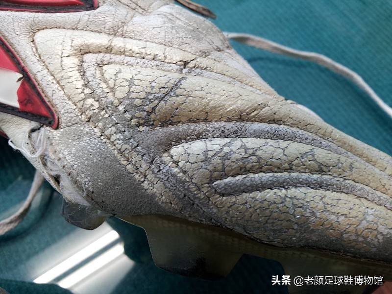 足球鞋的寿命有多长？老了以后会有哪些病？有病该怎么治疗？