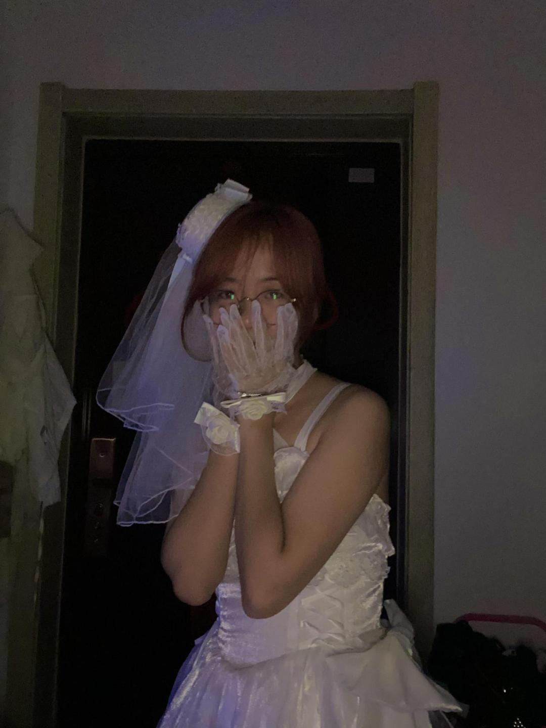 简单脊柱侧弯训练动作两个,1岁脊柱侧弯矫正动作