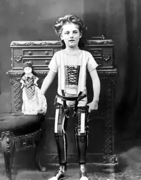 因为卫生棉条被截肢,女星因为卫生巾截肢