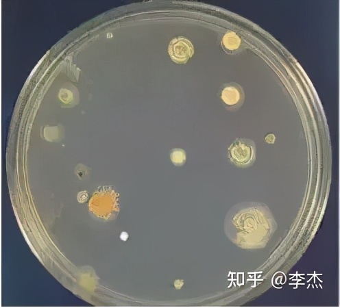 细胞培养出现链球菌污染怎么办,细胞培养如何应对支原体污染