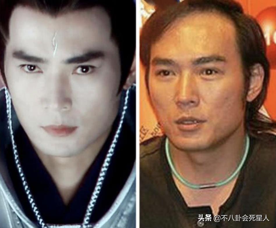 沙溢黄晓明脱发指数,沙溢秃顶头发稀疏