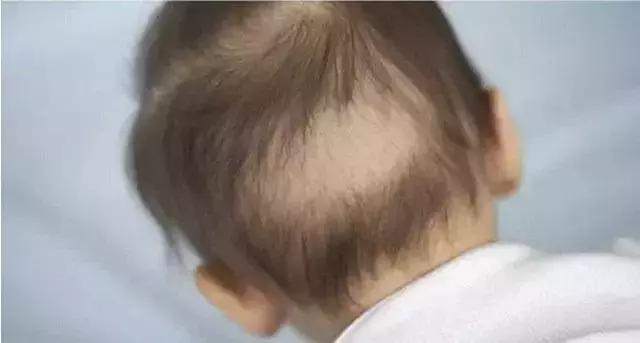 宝宝发烧哺乳期妈妈不能吃什么,宝宝发烧妈妈不能吃什么食物