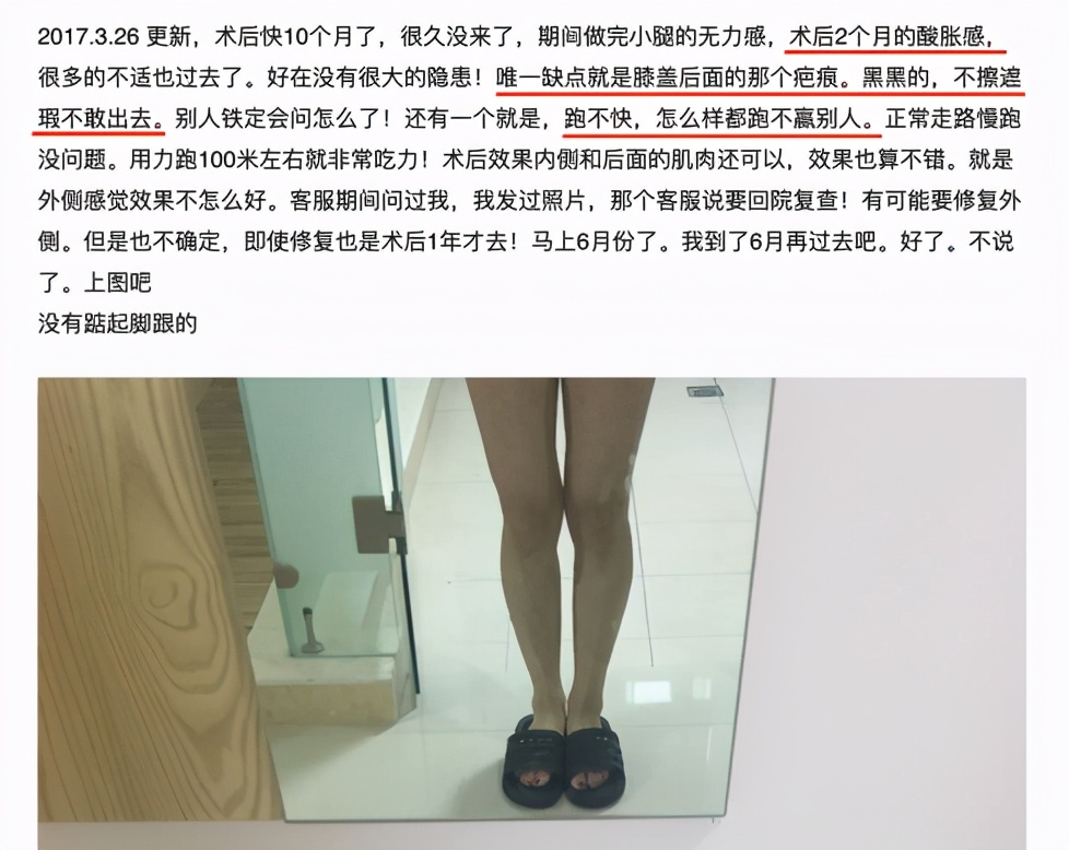 断筋瘦腿、断骨增高、精灵耳……女孩，请停止排队自残