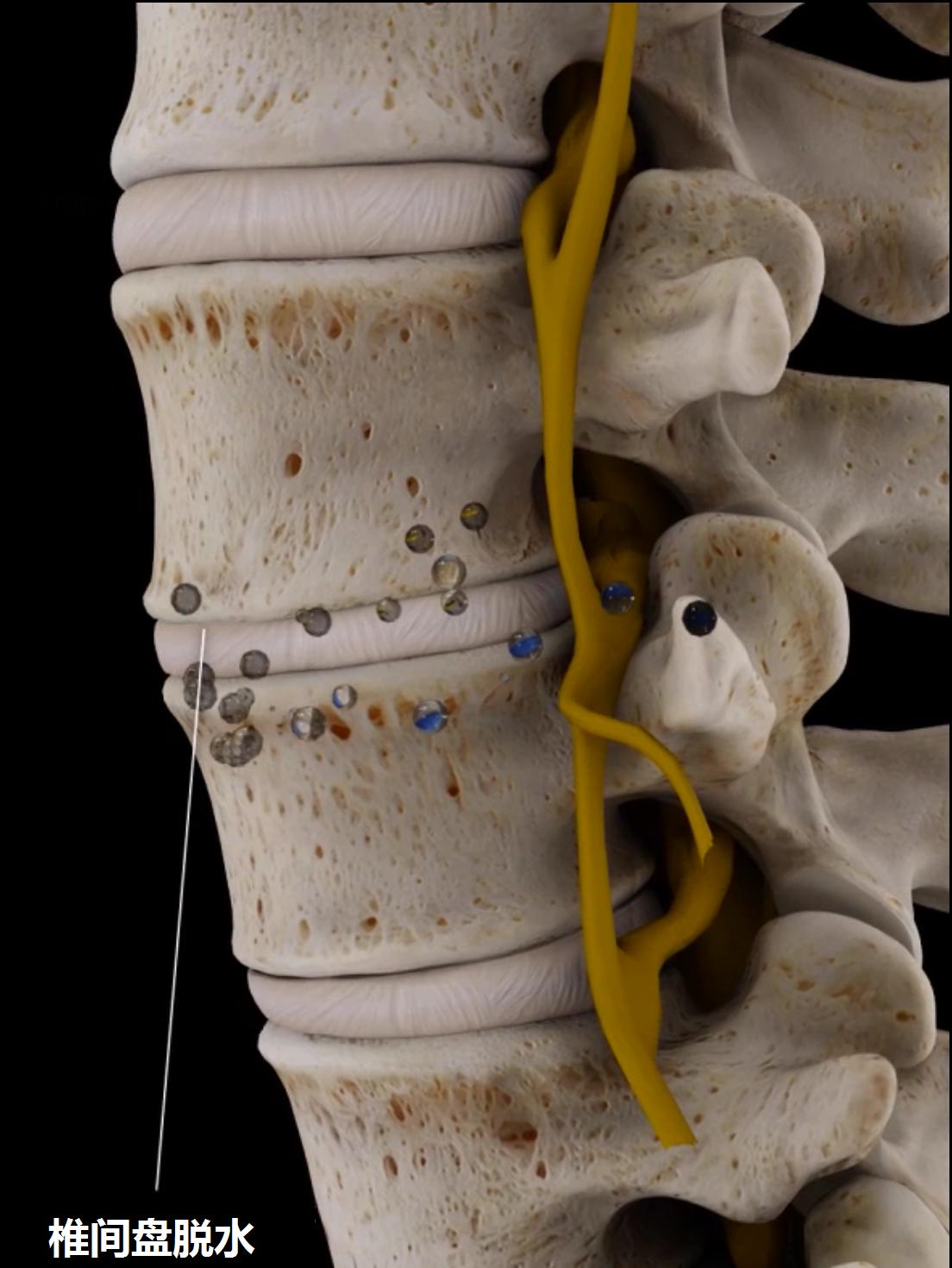 预防腰痛的正确方法,关于腰痛治疗方法有哪些