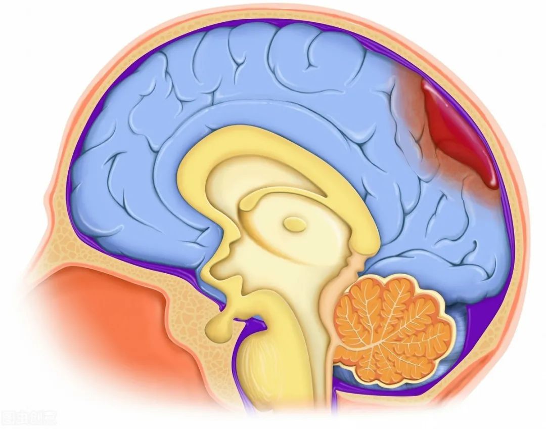 成人突发癫痫是什么原因引起的,引起癫痫发病的最常见病因有哪些
