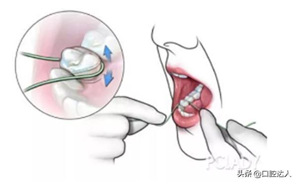 不补牙齿有问题吗,不补牙齿后牙齿会怎样