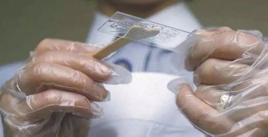 宫颈筛查都是哪些项目,宫颈筛查三个项目是哪三个