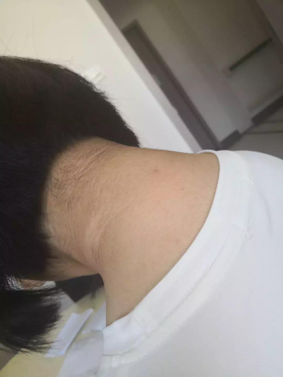 萝莉少女大长腿，为何腿毛长又黑？