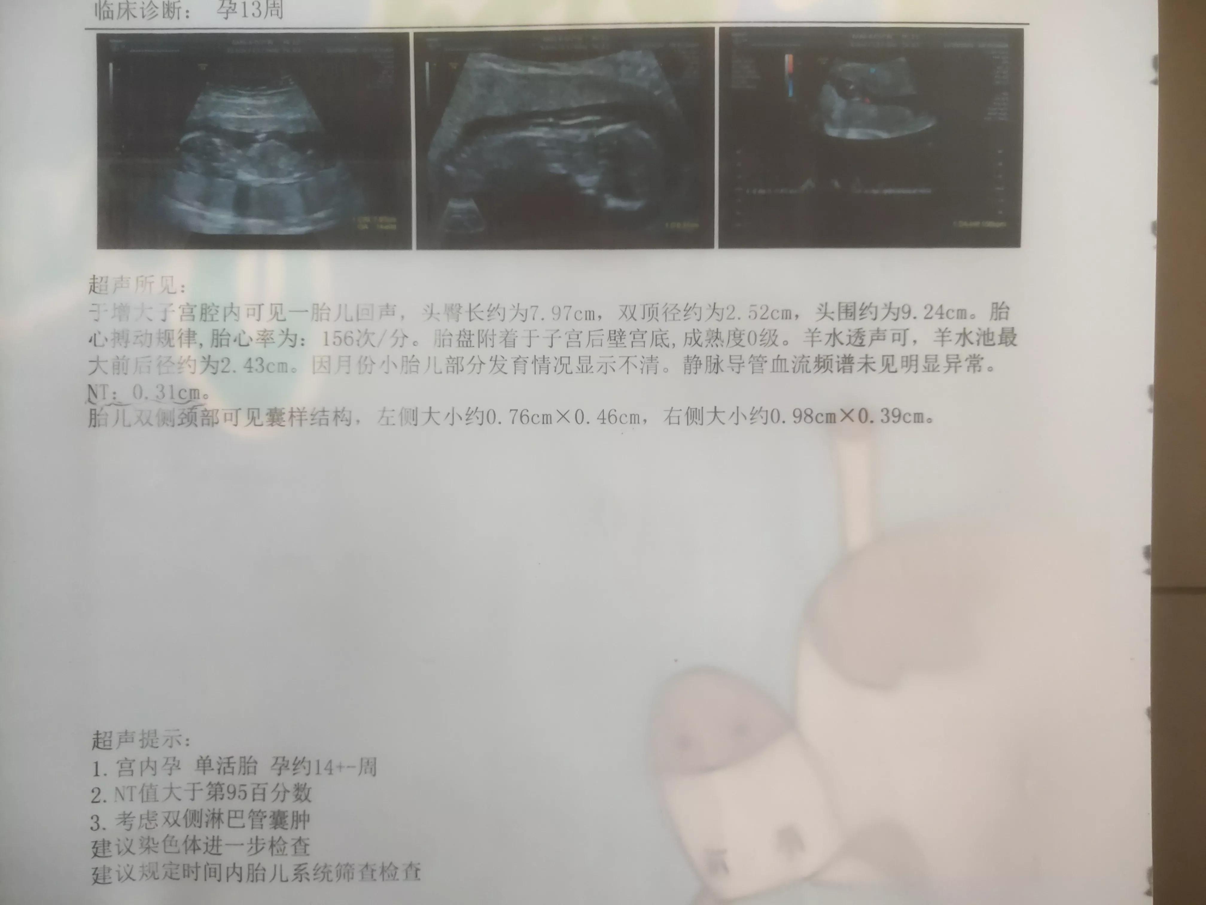 怀孕检查nt值超两倍怎么办,怀孕检查nt增厚