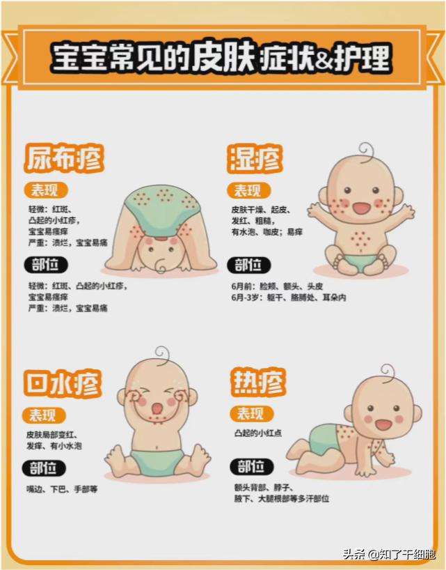 宝宝眼睛周围长湿疹要如何护理,孩子得了湿疹该怎么做好皮肤护理