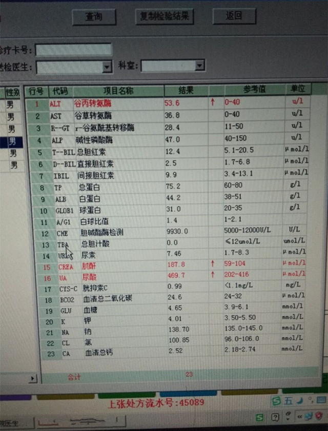 体外冲击波碎石术后肌酐升高，中药合理治疗后，肌酐戏剧性下降了