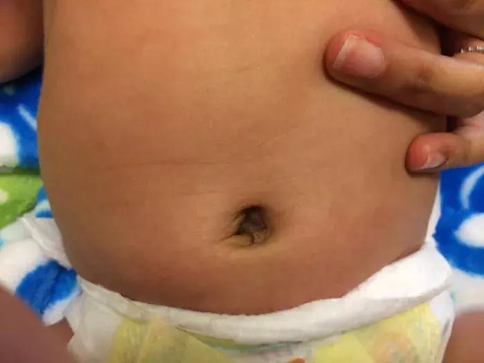 手指节皮肤发黑怎么回事啊,奇怪的手指图片