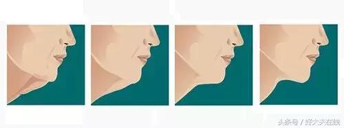 除皱祛斑抗衰老什么方法好,祛斑除皱最有效的医美手段