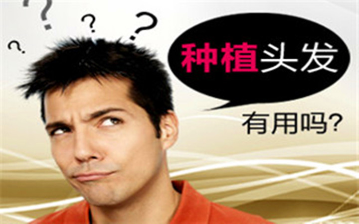 种头发到底有没有效果,种头发有用吗要多少钱