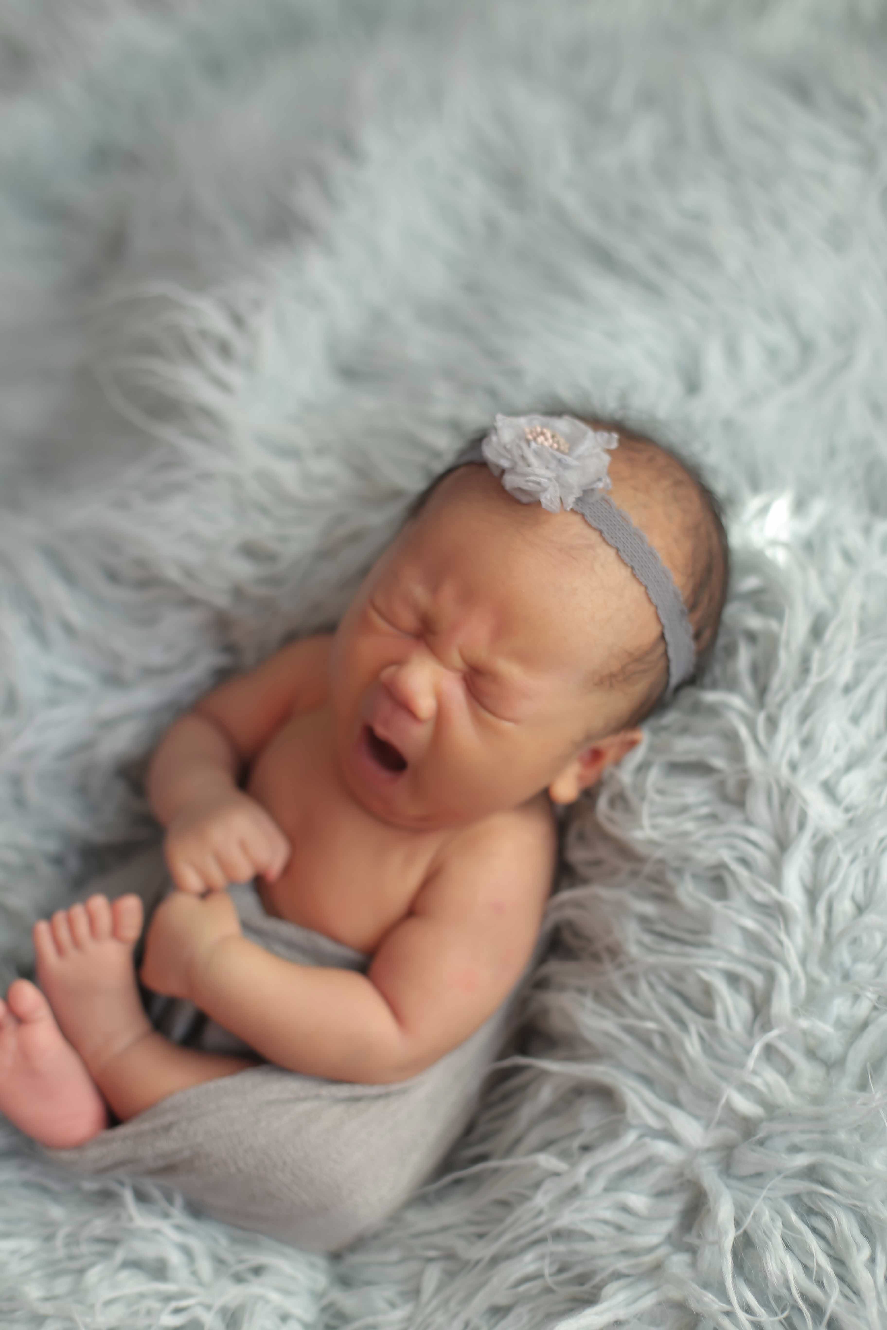 宝宝染上黄疸怎么办？