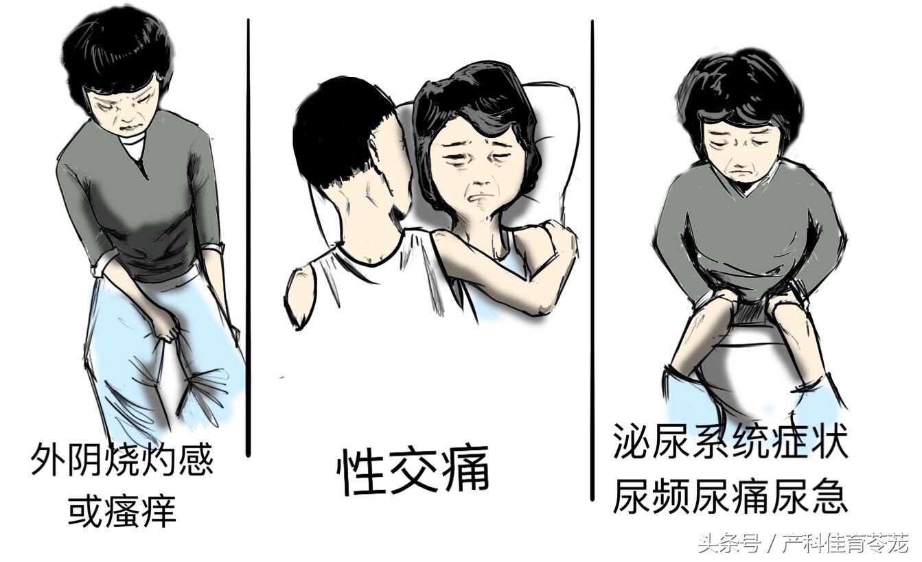 妇女外阴痒干涩用什么药膏,老年人外阴瘙痒干涩咋办