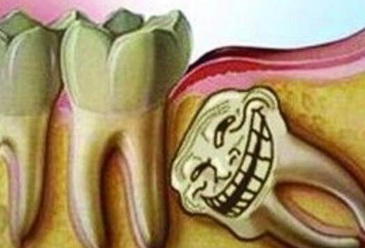 正畸与拔牙,正畸和种植哪个贵