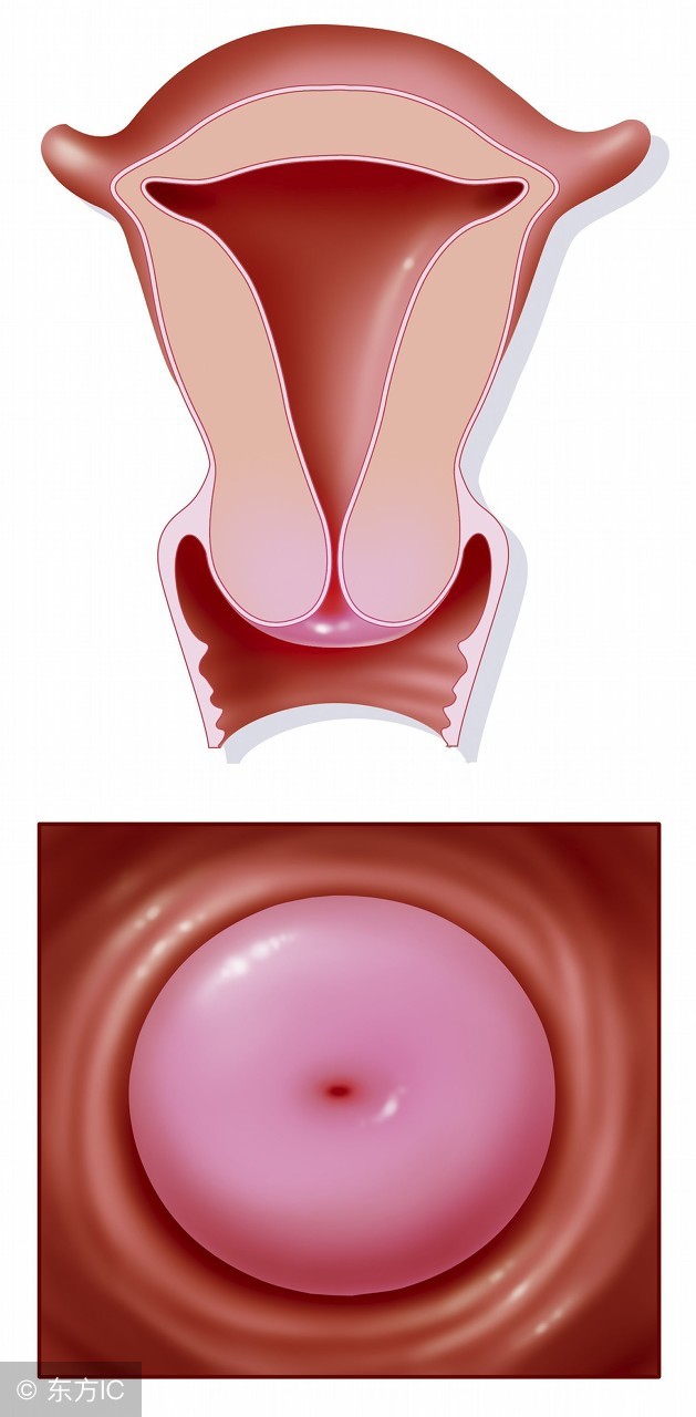 没结婚的女性会有宫颈糜烂吗,女生没结婚会得阴道炎吗