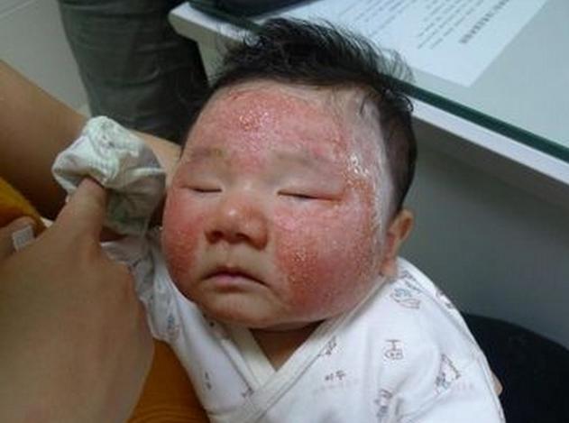 孕妇吃什么导致胎热,导致胎毒和胎热的食物有哪些