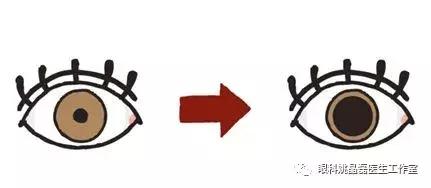 大眼睛十万个为什么之--为什么要散瞳？