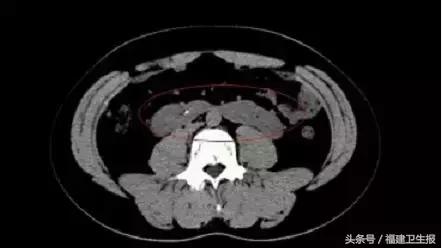 概率低于万分之一的事件,概率为几万分之一的事件