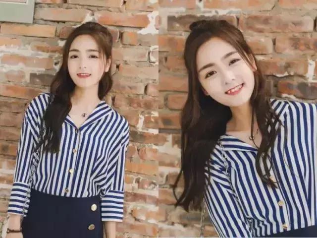 免费分享一个拯救发际线的方法,权威专家教你拯救发际线