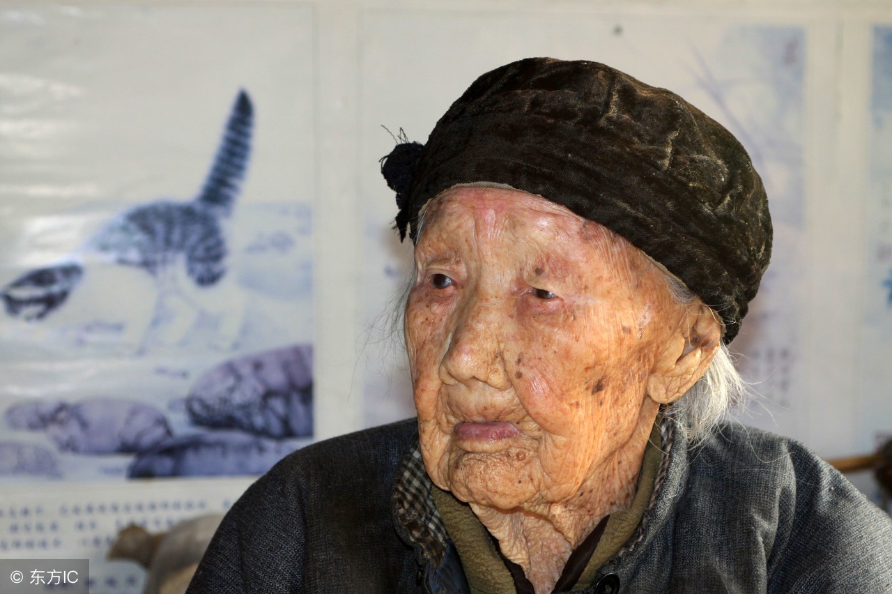 食用醋能祛除老年斑吗,鸡蛋加醋能去老年斑吗