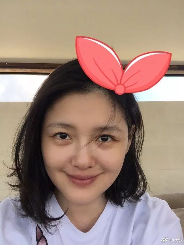 大s癫痫住院真相,大s回应因癫痫住院一事