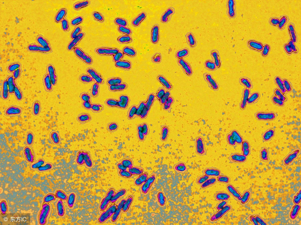细菌性小儿痢疾症状和治疗,预防细菌性痢疾的措施哪个为重点