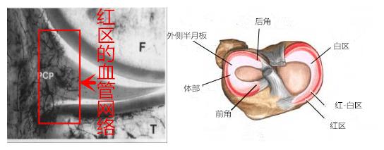 半月板损伤伴囊肿保守治疗,保守治疗膝关节半月板损伤