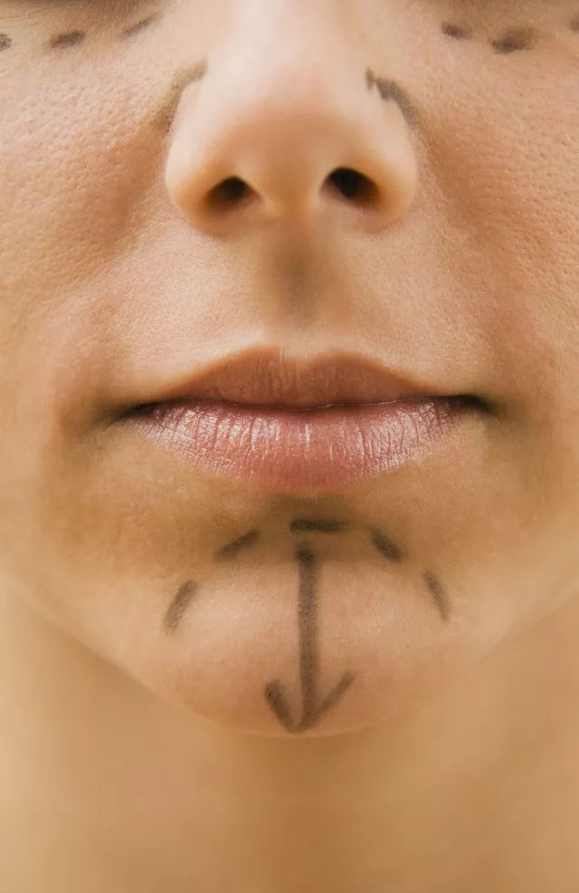 鼻子太大怎么变小,假鼻子真的能让鼻子变小吗