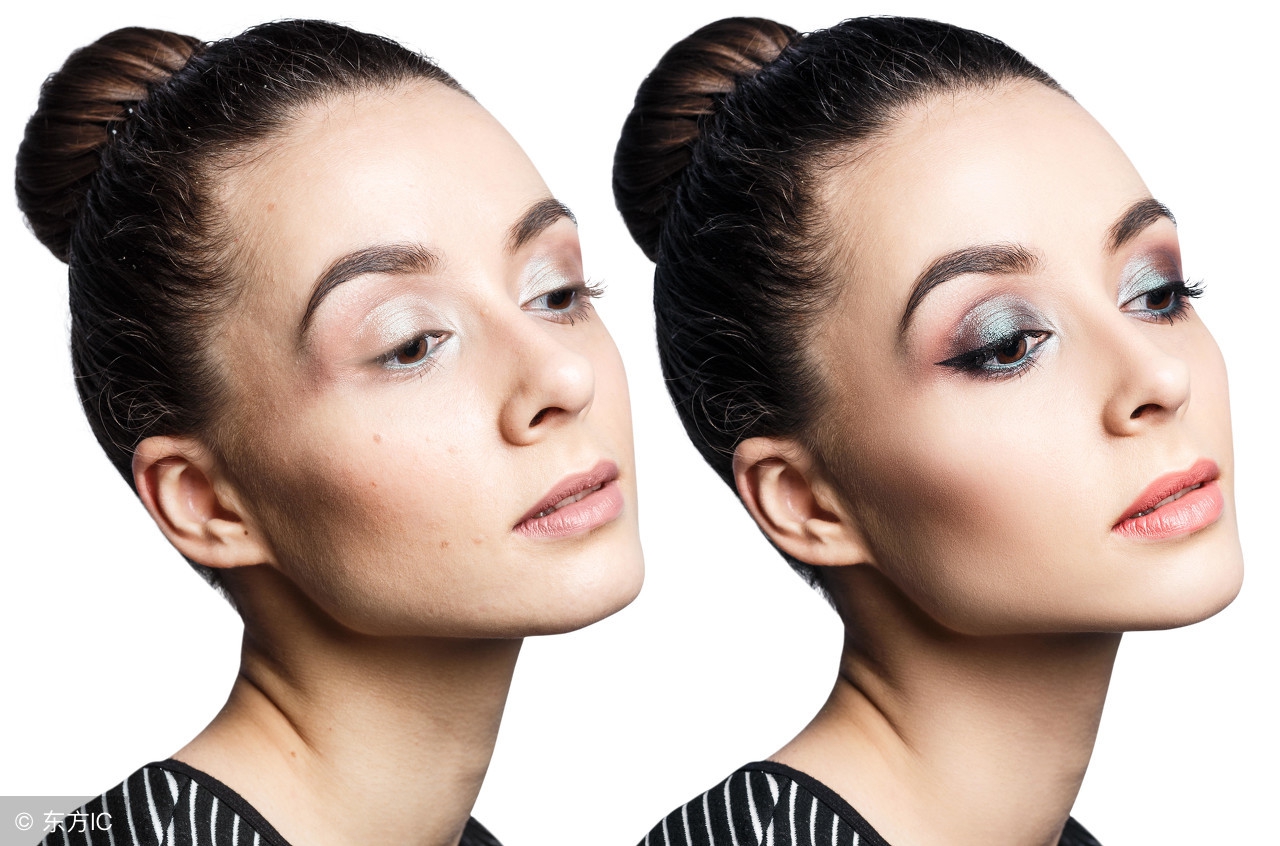 暗疮是体内有什么问题吗,暗疮原因