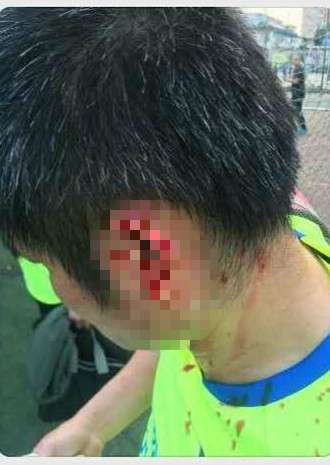 泰森咬耳朵裁判,泰森拳击比赛咬耳朵这一场谁赢了