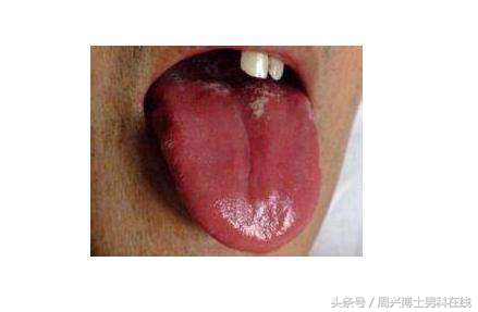 辨清“肾虚”,让大家明明白白“补肾”