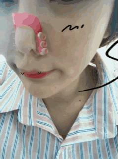 整形“神器”大测评：传说中的隆鼻夹真的靠谱吗？